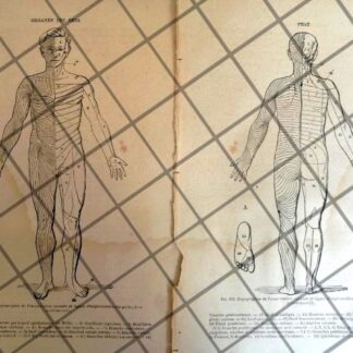 GRABADO MEDICO ANTIGUO 1877 PUNTOS NERVIOSOS. /14