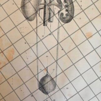 GRABADO MEDICO ANTIGUO 1877 SISTEMA URINARIO /11