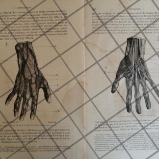 GRABADO MEDICO ANTIGUO 1877 NERVIOS EN MANOS /03