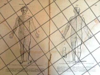 GRABADO MEDICO ANTIGUO 1877 PUNTOS NERVIOSOS. /14